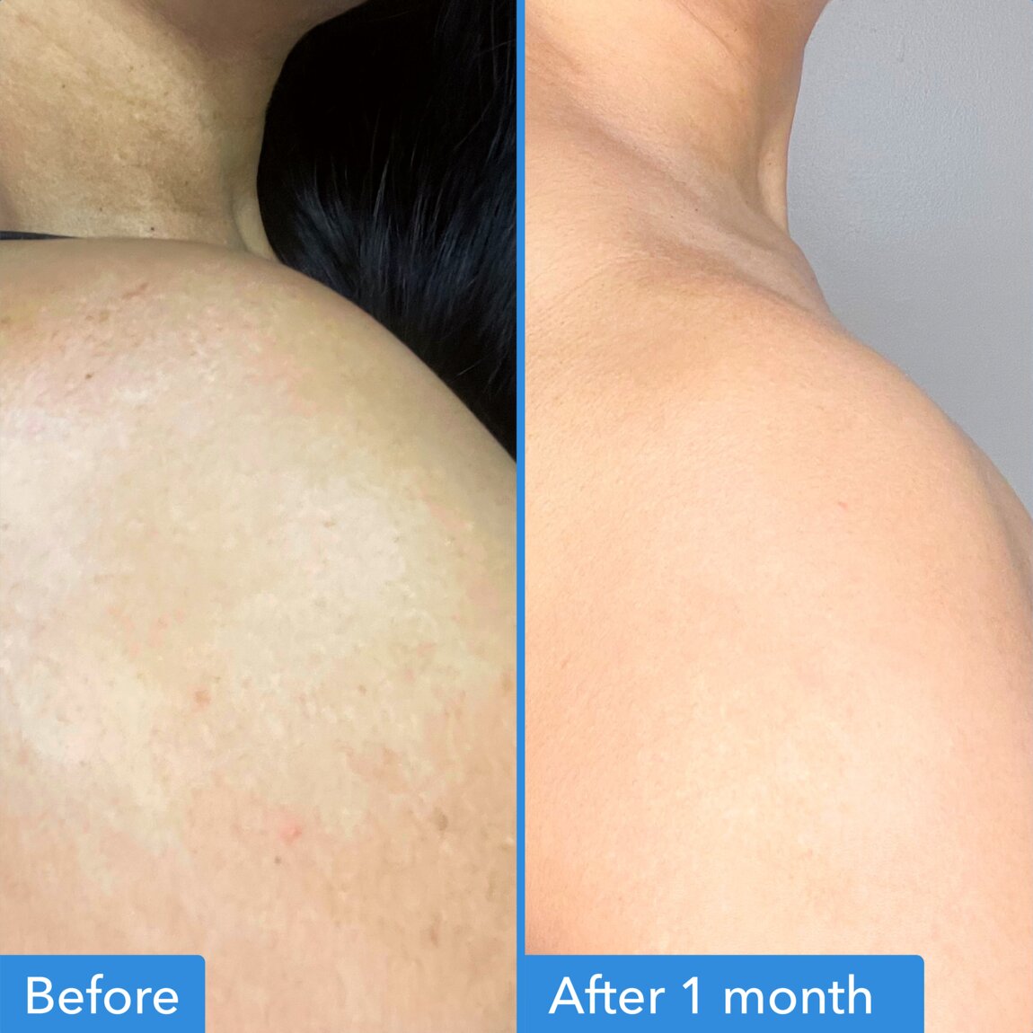 discoloration-correcting-body-treatment-m5 zb_p.jpg