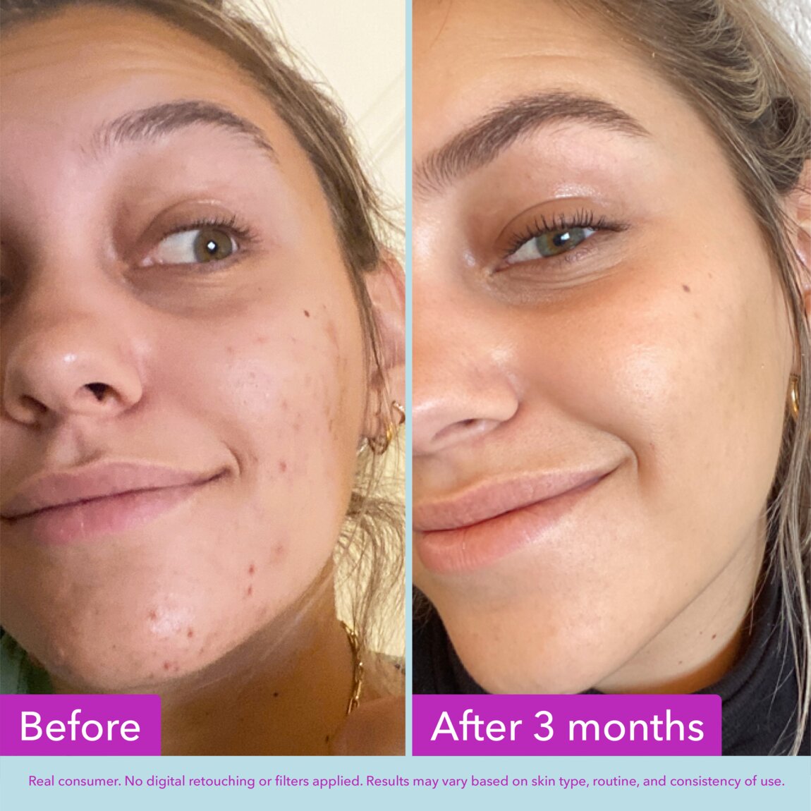niacinamide-brightening-toner-i7 zb_p.jpg