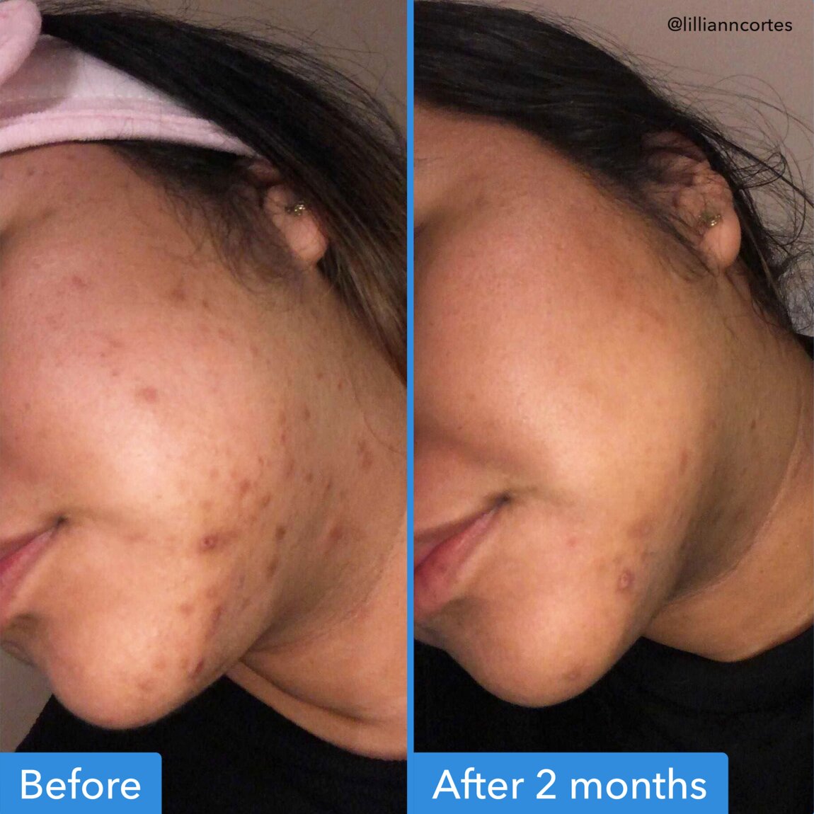 discoloration-correcting-serum-e2 zb_p.jpg
